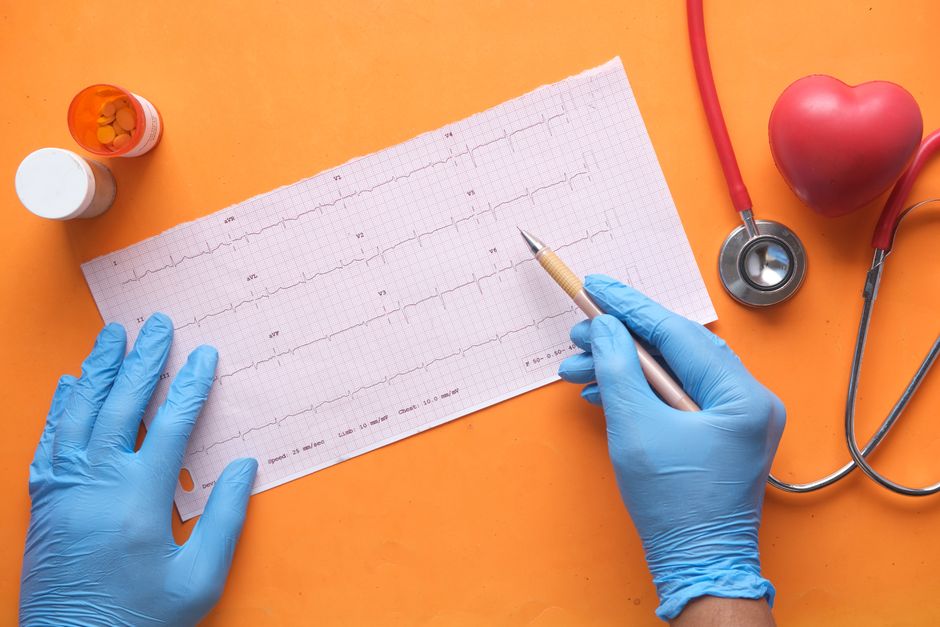 How Can I Tell Whether AFib Fatigue Is From AFib or Rate-Control Medication?